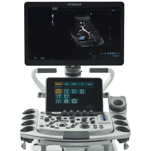 Hitachi Arietta 850 SE Аппарат УЗИ