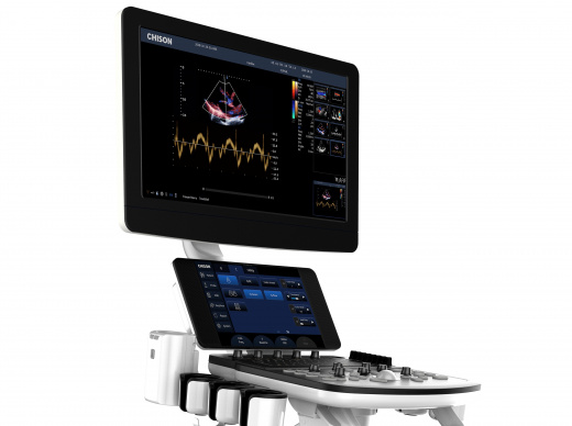 Chison Qbit 8 Аппарат УЗИ